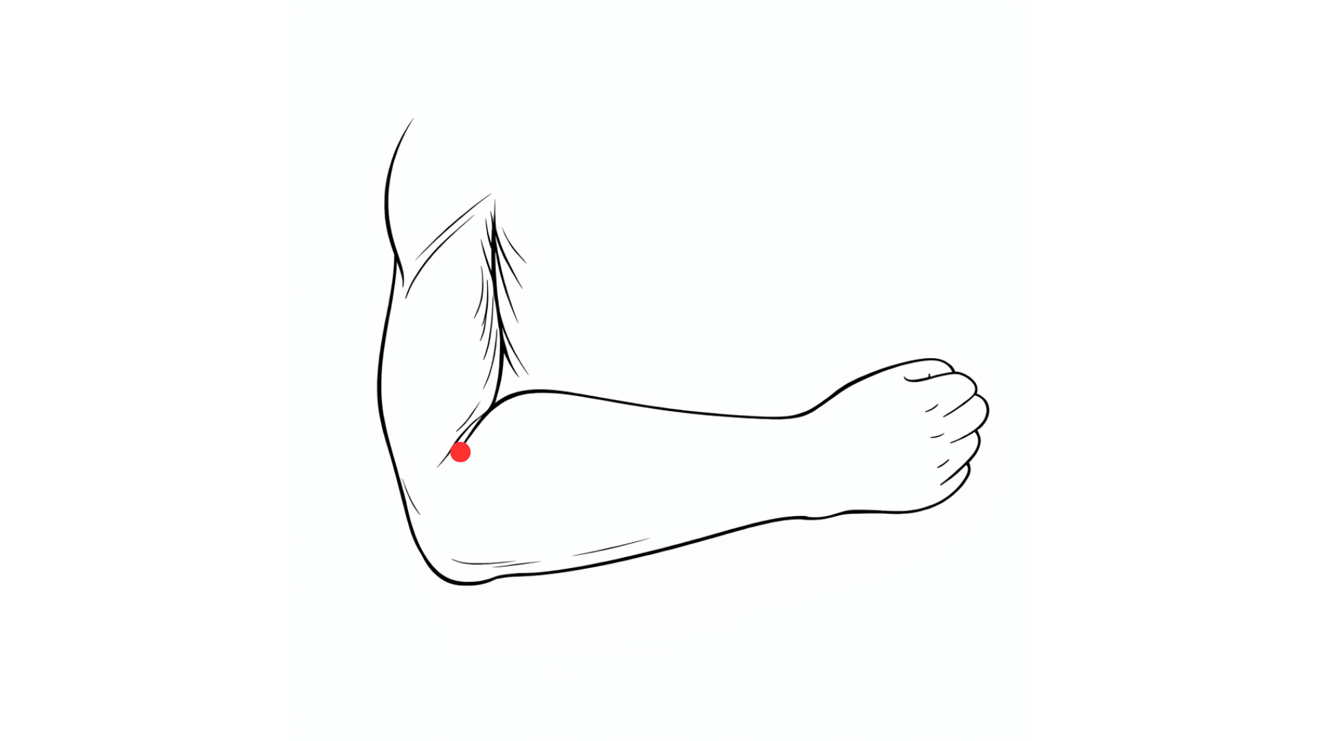 point acupuncture 11GI Quchi localisation coude eczéma démangeaisons médecine chinoise.