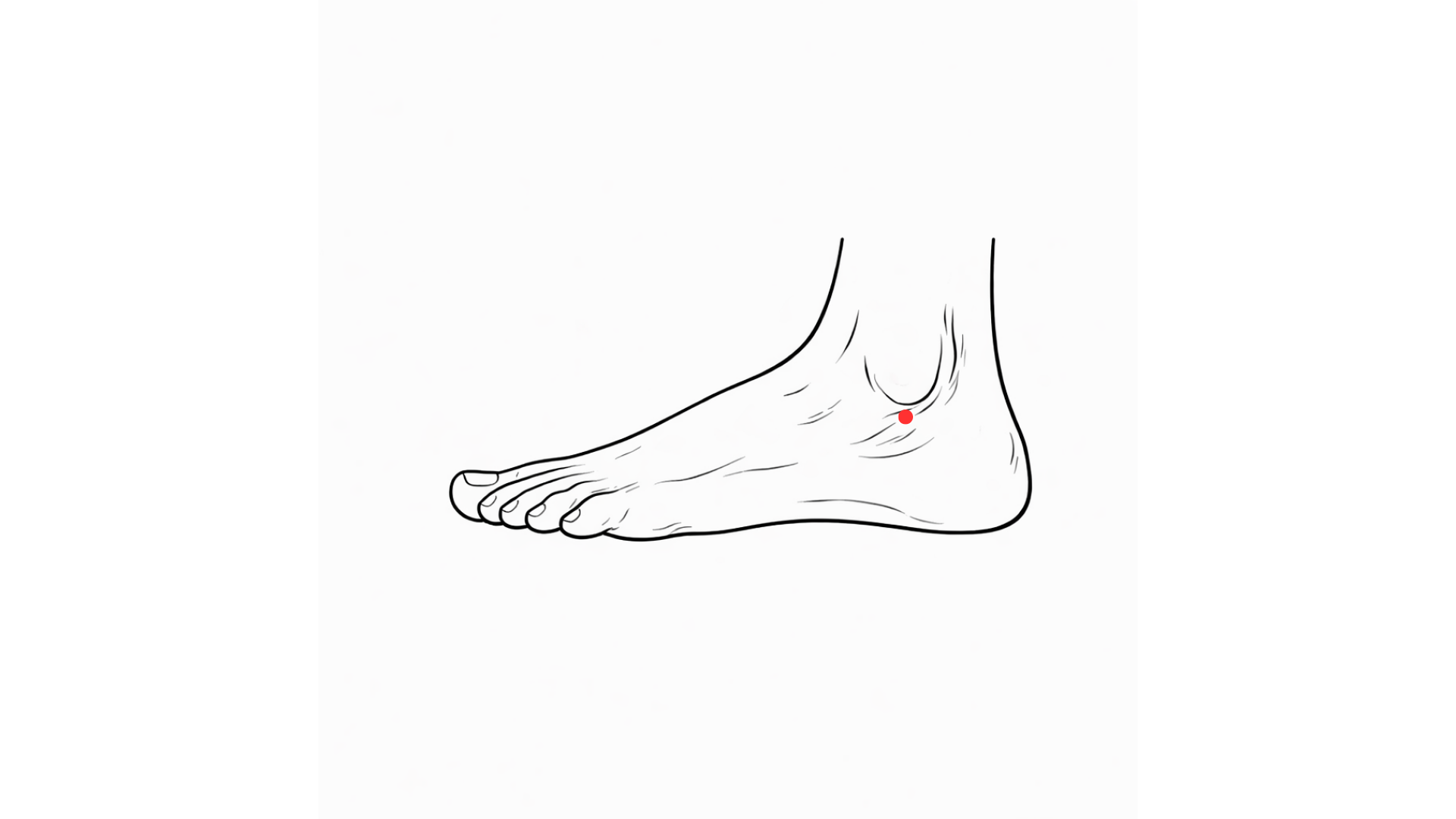 Point d’acupuncture 62V Shen Mai sous la malléole externe du pied droit pour maux de dos et insomnie.