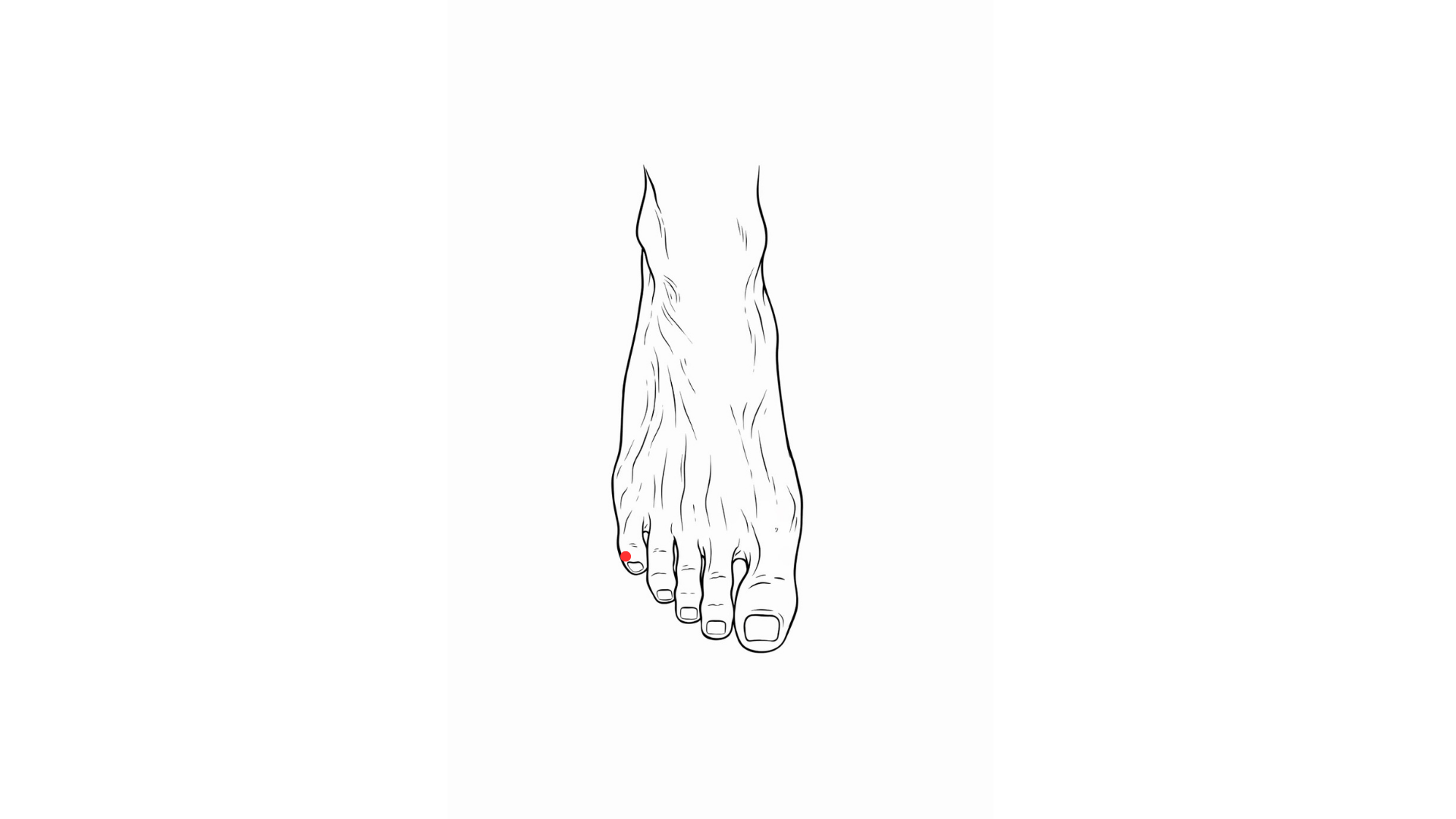 Point 67V Zhi Yin acupuncture petit orteil bébé siège maux de tête